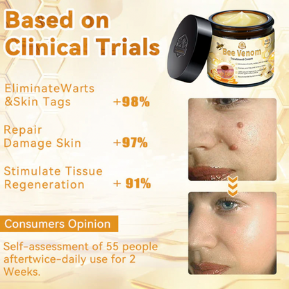 Bee Venom Treatment